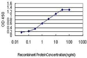 Detection limit for recombinant GST tagged MCC is approximately 0. (MCC 抗体  (AA 31-130))