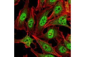 Immunofluorescence analysis of Hela cells using CRAM1 mouse mAb (green). (CARM1 抗体)