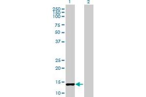 Western Blot analysis of CCNB3 expression in transfected 293T cell line by CCNB3 MaxPab polyclonal antibody. (Cyclin B3 抗体  (AA 1-111))