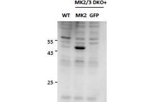 Western Blotting (WB) image for anti-Mitogen-Activated Protein Kinase-Activated Protein Kinase 2 (MAPKAPK2) antibody (ABIN5903087) (MAPKAP Kinase 2 抗体)