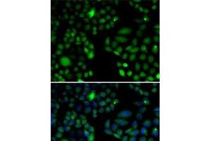 Immunofluorescence analysis of U2OS cells using EPC1 Polyclonal Antibody (EPC1 抗体)
