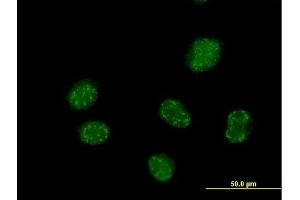 Immunofluorescence of purified MaxPab antibody to ELAC1 on HeLa cell. (ELAC1 抗体  (AA 1-363))