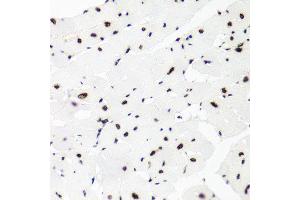 Immunohistochemistry of paraffin-embedded rat heart using H2AFX antibody at dilution of 1:100 (x40 lens). (H2AFX 抗体)