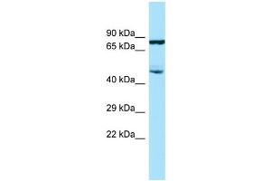 WB Suggested Anti-SMAP2 Antibody Titration: 1.