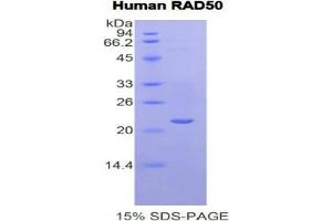 SDS-PAGE analysis of Human RAD50 Protein. (RAD50 蛋白)