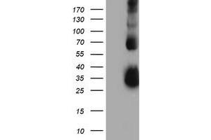 Western Blotting (WB) image for anti-Metalloproteinase Inhibitor 2 (TIMP2) antibody (ABIN1501396) (TIMP2 抗体)