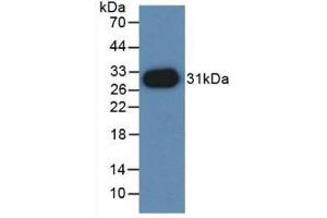 Detection of Recombinant PVRL2, Mouse using Polyclonal Antibody to Nectin 2 (NECTIN2)