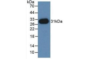 Detection of Recombinant PVRL2, Mouse using Polyclonal Antibody to Nectin 2 (NECTIN2) (PVRL2 抗体  (AA 83-291))