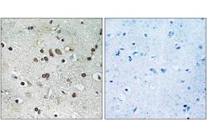 Immunohistochemistry analysis of paraffin-embedded human brain tissue, using BTF3L4 Antibody. (BTF3L4 抗体  (AA 94-143))