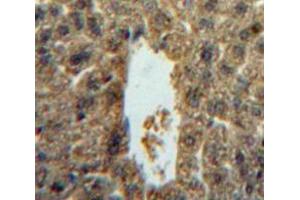 Used in DAB staining on fromalin fixed paraffin- embedded liver tissue (IL-5 抗体  (AA 20-134))