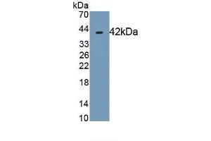 Detection of Recombinant TSPAN30, Human using Monoclonal Antibody to Tetraspanin 30Cluster of Differentiation 63 (CD63) (CD63 抗体  (AA 103-203))
