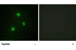 Immunofluorescence analysis of A-549 cells, using TBX1 polyclonal antibody . (T-Box 1 抗体  (C-Term))