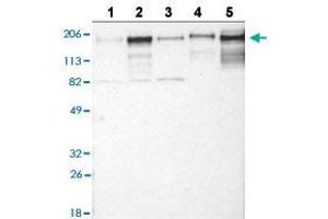 Western blot analysis of Lane 1: RT-4 cell line, Lane 2: U-251MG sp cell line, Lane 3: A-431 cell line, Lane 4: human liver tissue, and Lane 5: human tonsil tissue with LAMC1 polyclonal antibody . (Laminin gamma 1 抗体  (AA 1442-1552))