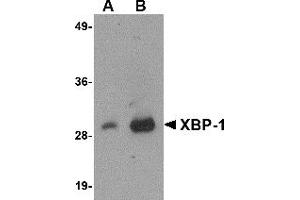 Western Blotting (WB) image for anti-X-Box Binding Protein 1 (XBP1) (AA 2-160) antibody (ABIN492538) (XBP1 抗体  (AA 2-160))
