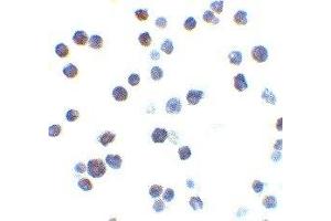 Immunohistochemistry (IHC) image for anti-BCL2-Antagonist/killer 1 (BAK1) (N-Term) antibody (ABIN2477580) (BAK1 抗体  (N-Term))