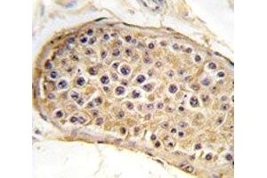 IHC analysis of FFPE human testis tissue stained with RICTOR antibody (RICTOR 抗体  (AA 236-267))