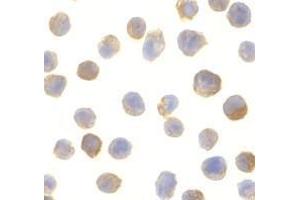 Immunocytochemistry of CTRP2 in Jurkat cells with AP30250PU-N CTRP2 antibody at 10 μg/ml. (C1QTNF2 抗体)