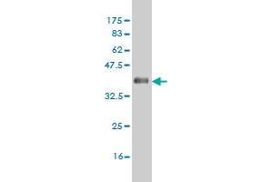 Western Blot detection against Immunogen (36. (CSNK1G1 抗体  (AA 293-393))