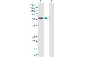 Western Blot analysis of IRX2 expression in transfected 293T cell line by IRX2 MaxPab polyclonal antibody. (IRX2 抗体  (AA 1-471))