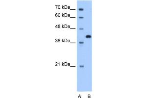 WB Suggested Anti-TOR2A Antibody Titration:  1. (TOR2A 抗体  (N-Term))
