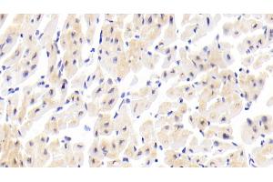 Immunohistochemistry (IHC) image for anti-ATPase, Ca++ Transporting, Cardiac Muscle, Slow Twitch 2 (ATP2A2) (AA 315-756) antibody (ABIN7436261)