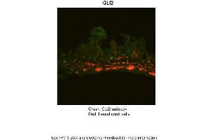 Immunohistochemistry (IHC) image for anti-GLI Family Zinc Finger 2 (GLI2) (Middle Region) antibody (ABIN2777474)