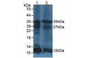 Western Blot; Sample: Lane1: Human leukocyte Cells; Lane2: Human Lymphocytes Cells. (IL12A 抗体  (AA 23-219))
