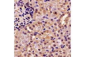 Immunohistochemical analysis of Pancreatic Lipase staining in rat kidney formalin fixed paraffin embedded tissue section.