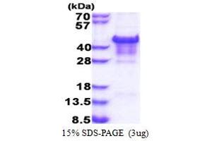 SDS-PAGE (SDS) image for Carbonic Anhydrase XIV (CA14) (AA 16-290) (Active) protein (His tag) (ABIN5853447) (CA14 Protein (AA 16-290) (His tag))