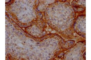 IHC image of ABIN7127578 diluted at 1:100 and staining in paraffin-embedded human placenta tissue performed on a Leica BondTM system. (Recombinant CD51 抗体)