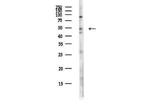 Western blot analysis of lysates from PC12 cells(heat-shock,45 min treatment), using FEZF2 Antibody at 1/1000 dilution.