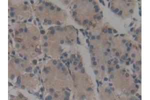 Immunohistochemistry (IHC) image for anti-Calumenin (CALU) (AA 20-315) antibody (ABIN7434203)