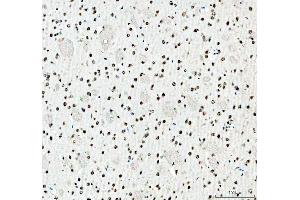 IHC analysis of SFPQ using anti-SFPQ antibody (ABIN7603089). (SFPQ 抗体  (Middle Region))