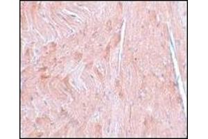 Immunohistochemistry of REEP3 in mouse heart tissue with this product at 5 μg/ml.
