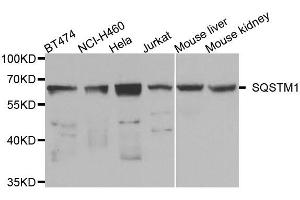 Western blot analysis of extracts of various cell lines, using SQSTM1 antibody. (SQSTM1 抗体)