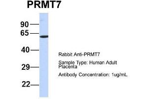 Host:  Rabbit  Target Name:  PRMT7  Sample Type:  Human Adult Placenta  Antibody Dilution:  1. (PRMT7 抗体  (N-Term))