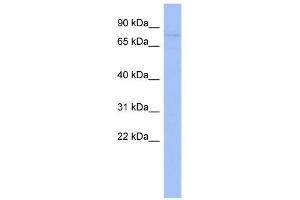 WB Suggested Anti-ZNF219 Antibody Titration:  0. (ZNF219 抗体  (Middle Region))