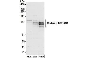 anti-Codanin 1 (CDNA1) (AA 1177-1227) antibody