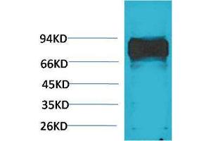 Western Blotting (WB) image for anti-V-Raf-1 Murine Leukemia Viral Oncogene Homolog 1 (RAF1) antibody (ABIN3181567) (RAF1 抗体)