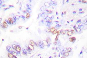 Image no. 1 for anti-X-Ray Repair Complementing Defective Repair in Chinese Hamster Cells 3 (XRCC3) antibody (ABIN271981) (XRCC3 抗体)