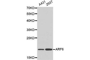 Western blot analysis of A431 cell and 293T cell lysate using ARF6 antibody. (ARF6 抗体  (AA 1-175))