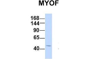 Western Blotting (WB) image for anti-Myoferlin (MYOF) (C-Term) antibody (ABIN2782797)