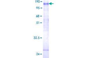 Image no. 1 for Fibroblast Growth Factor Receptor 4 (FGFR4) (AA 1-802) protein (GST tag) (ABIN1354045)