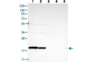 Western blot analysis of Lane 1: RT-4, Lane 2: U-251 MG, Lane 3: Human Plasma, Lane 4: Liver, Lane 5: Tonsil with TIMM17B polyclonal antibody . (TIMM17B 抗体)