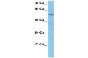 Western Blotting (WB) image for anti-Proto-oncogene tyrosine-protein kinase Src (Src) (N-Term) antibody (ABIN2779669)