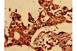 Immunohistochemistry (IHC) image for anti-Glutamate Receptor, Ionotropic, N-Methyl D-Aspartate 2a (GRIN2A) (AA 501-750) antibody (ABIN7153987)