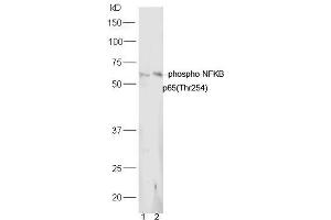 Lane 1: Mouse lung lysates Lane 2: Mouse spleen lysates probed with Rabbit Anti-NFkB p65 (Thr254) Polyclonal Antibody, Unconjugated (ABIN712886) at 1:300 overnight at 4˚C. (NF-kB p65 抗体  (pThr254))