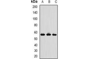 Western blot analysis of TCP1-delta expression in MCF7 (A), THP1 (B), mouse spleen (C) whole cell lysates. (CCT4 抗体)
