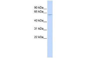 NT5C1B antibody used at 1 ug/ml to detect target protein. (NT5C1B 抗体  (N-Term))