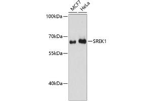Western blot analysis of extracts of various cell lines, using SREK1 antibody (ABIN6132836, ABIN6148434, ABIN6148435 and ABIN6217160) at 1:3000 dilution. (SFRS12 抗体  (AA 1-180))